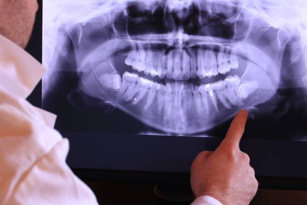 Best Emergency Denture Repair in Wallenuck Lake Estates, PA