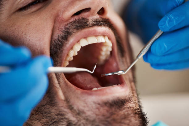 Best Emergency Root Canal Therapy in Wallenuck Lake Estates, PA